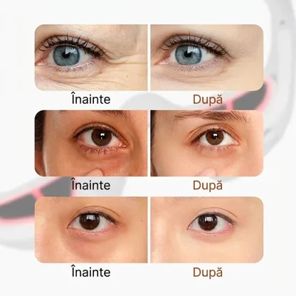 EyeGlow™ ochelari de îngrijire oculară cu terapie prin lumină